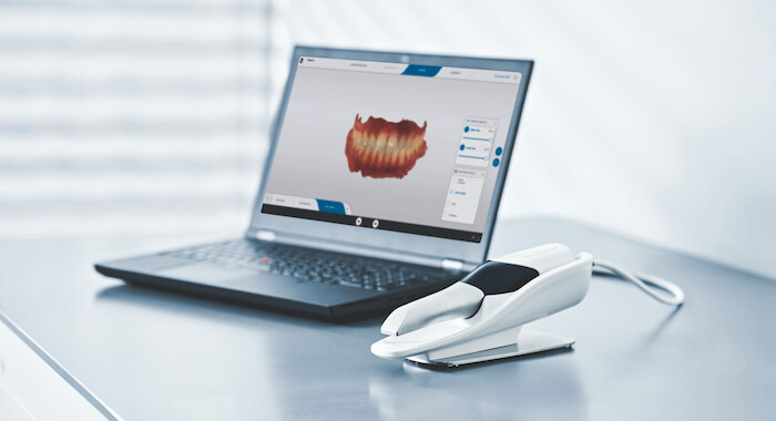 primescan connect laptop scanner cradle
